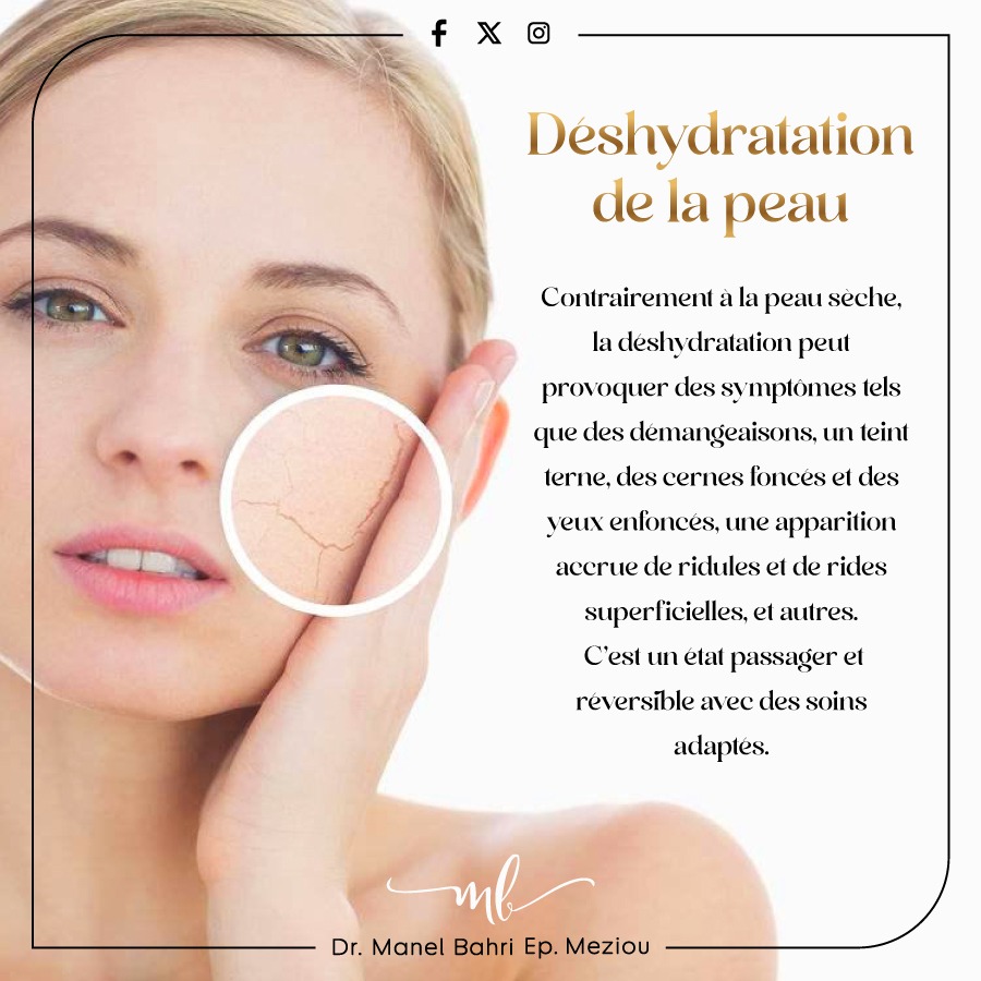 Déhydratation de la peau