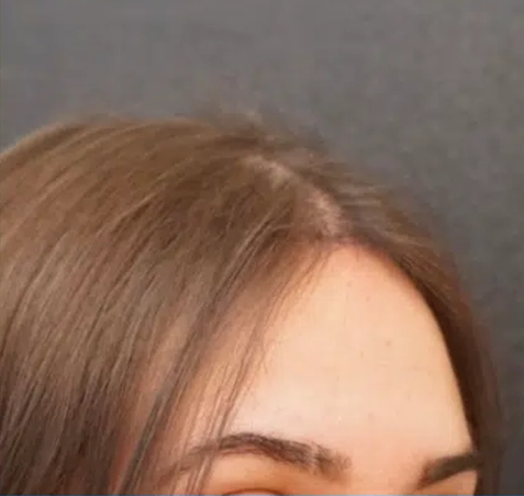 Image du témoignage